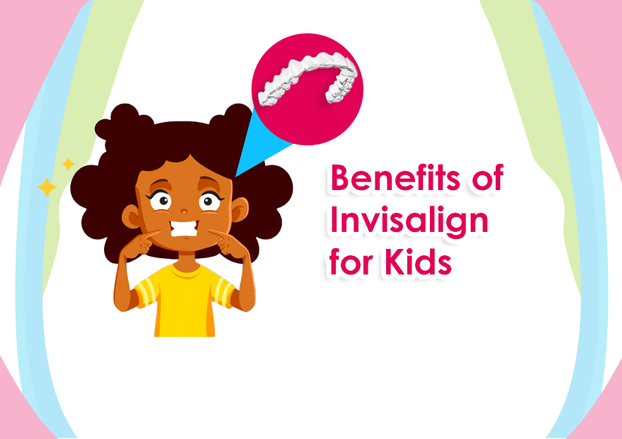Benefits of Invisalign for Kids