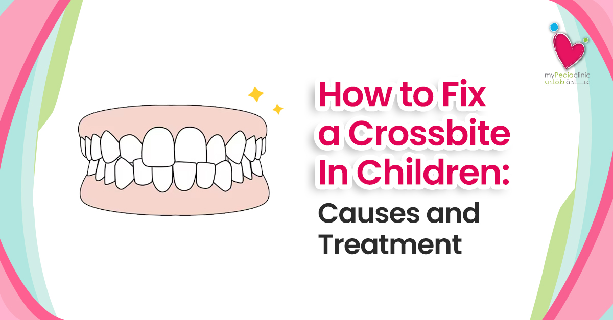 How to Fix a Crossbite In Children: Causes and Treatment