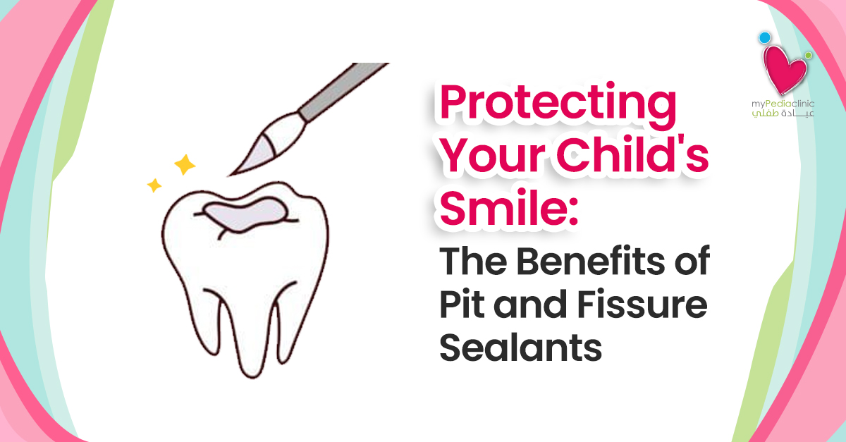 Protecting Your Child's Smile: The Benefits of Pit and Fissure Sealants
