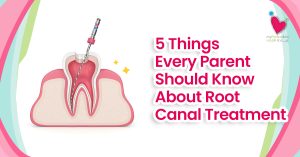 My Pedia Clinic - MPC 5 Things Every Parent Should Know About Root Canal Treatment