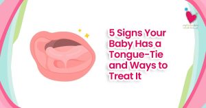 5 Signs Your Baby Has a Tongue-Tie and Ways to Treat It