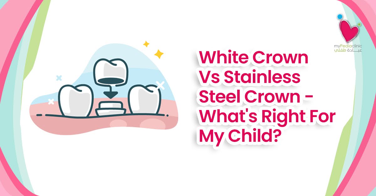 White Crown Vs Stainless Steel Crown