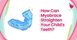 My Pedia Clinic - Our Blog 6 How Can Myobrace Straighten Your Child's Teeth