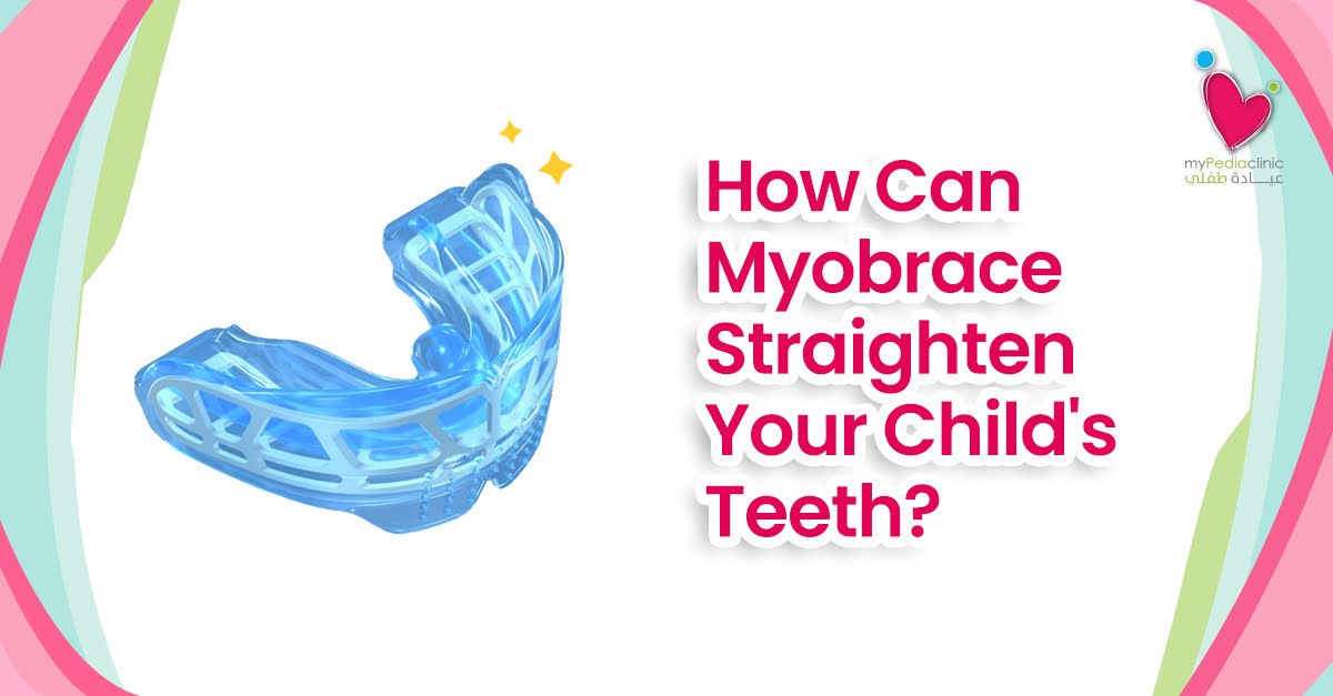 How Can Myobrace Straighten Your Child's Teeth