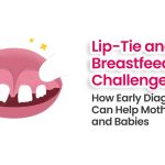 Lip - Tie Breastfeeding Challenges