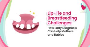 Lip - Tie Breastfeeding Challenges