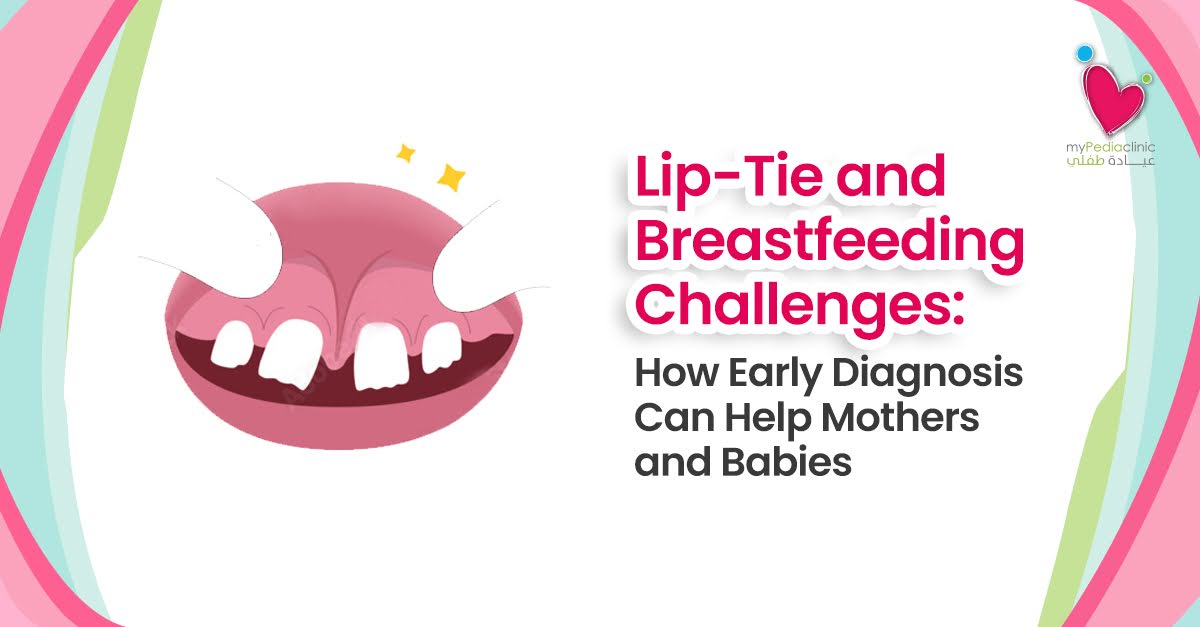 Lip - Tie Breastfeeding Challenges