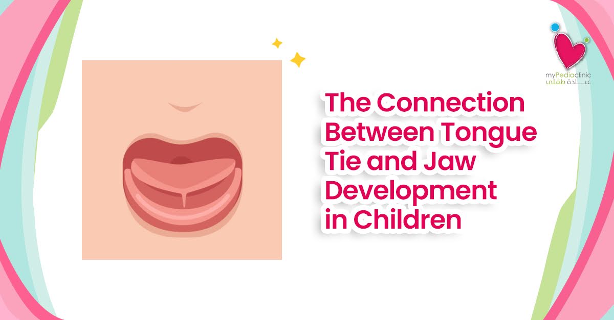 The Connection Between Tongue Tie and Jaw Development in Children