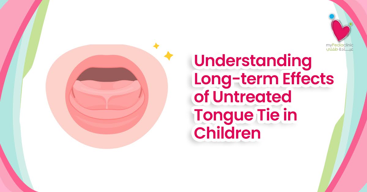 Understanding Long-term Effects of Untreated Tongue Tie in Children