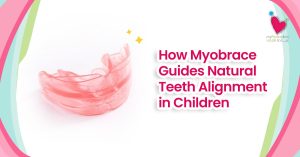 How Myobrace Guides Natural Teeth Alignment in Children