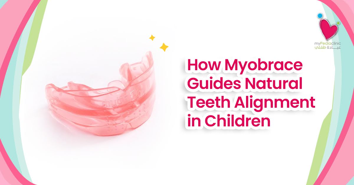 How Myobrace Guides Natural Teeth Alignment in Children