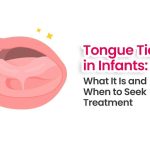 Tongue Tie in Infants What It Is and When to Seek Treatment