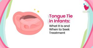 Tongue Tie in Infants What It Is and When to Seek Treatment