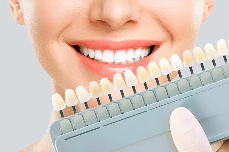 Veneers, Aesthetic And Cosmetic Dentistry